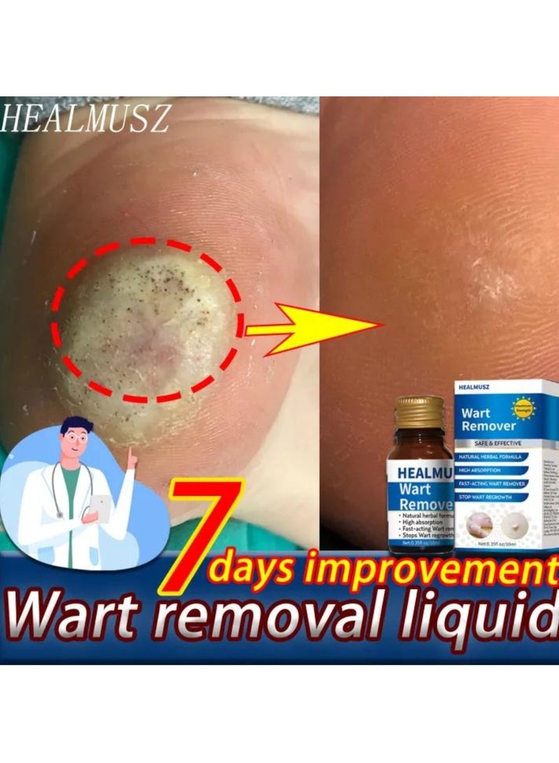 HEALMUSZ Wart Remover Skin Tag Remover Mole Corrector Skin Tag Removal and Repair Lotion Wart and Mole Remover Easy to Use Skin Tag Remover Safe and Effective Easy to use at Home Skin Tag Removal Serum 10ml  - Image 5