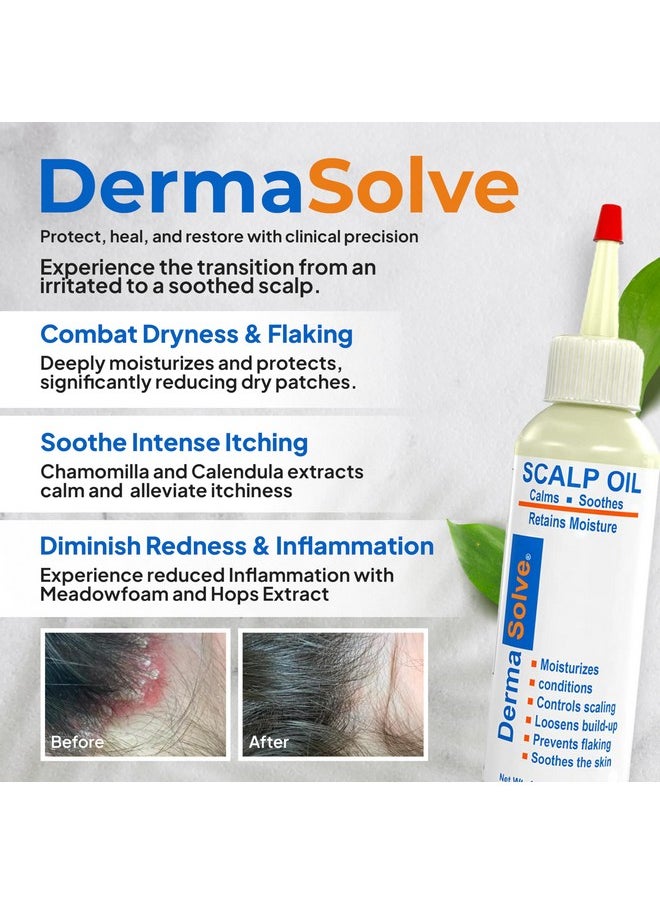 Dermasolve Dermasolve 4 oz Psoriasis, Seborrheic Dermatitis, & Dandruff Scalp Oil | Dermatologist Approved | Itchy, Flaky Scalp Relief | Clinically Tested, Long-Lasting Itch-Free, High-Performance Formula  - Image 2