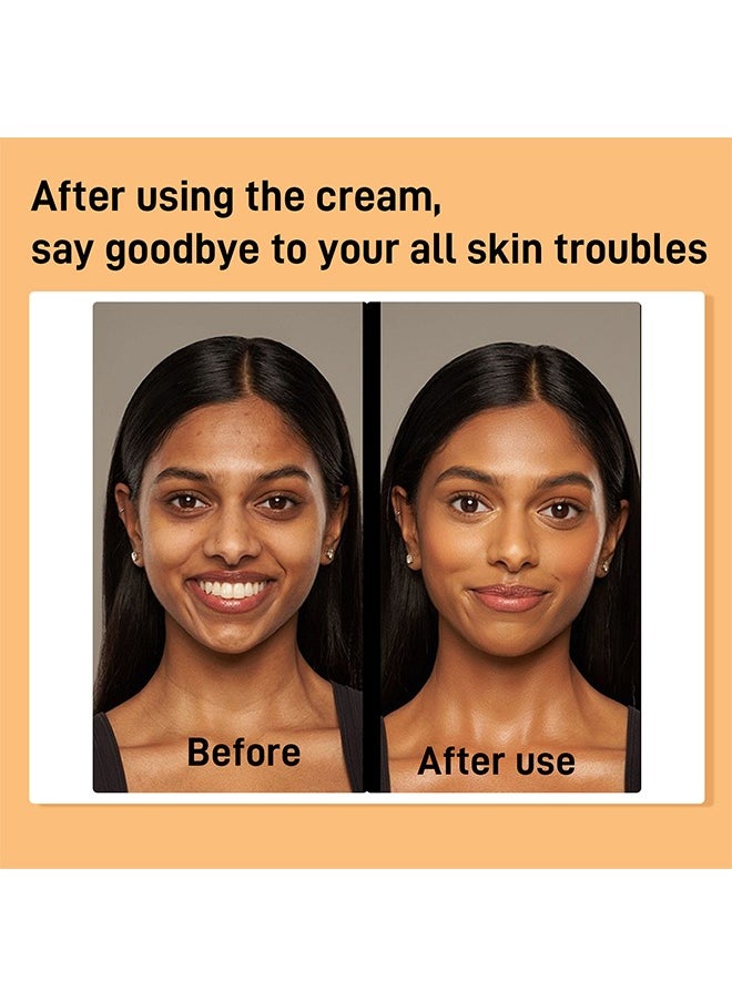 RUBRIEL Turmeric + Kojic Acid Cream,Soothes Wrinkles,Anti-Aging And Brightening,Brightens Skin,Removes Acne, Whitening, Lightening Spots 50g  - Image 4