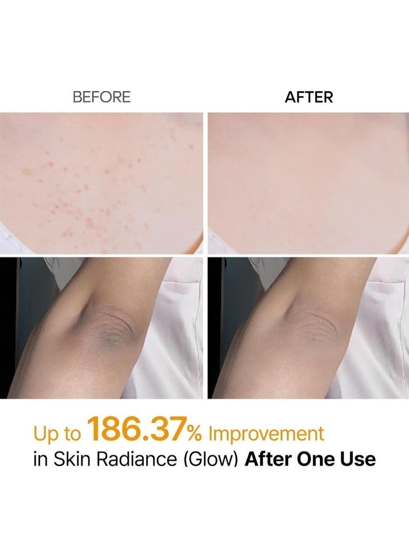 Dr. Peel Shot Exfoliating Spray 200ml with Kojic Acid & Turmeric for Brightening Skin - Image 3