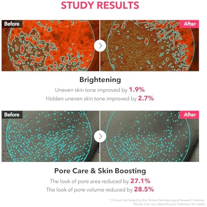 APRILSKIN TXA Niacinamide Toning Shot 99 Spicule Facial Serum｜Skin Booster Serum for Brightening and Pore Care｜99% High-Purity Tranexamic Acid 3% + Niacinamide 5%｜Korean Skin Care｜1.01 fl. oz. - Image 5