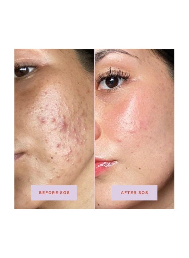 تاور 28 بخاخ الوجه SOS (أنقذوا بشرتنا) 120 مل - Image 2