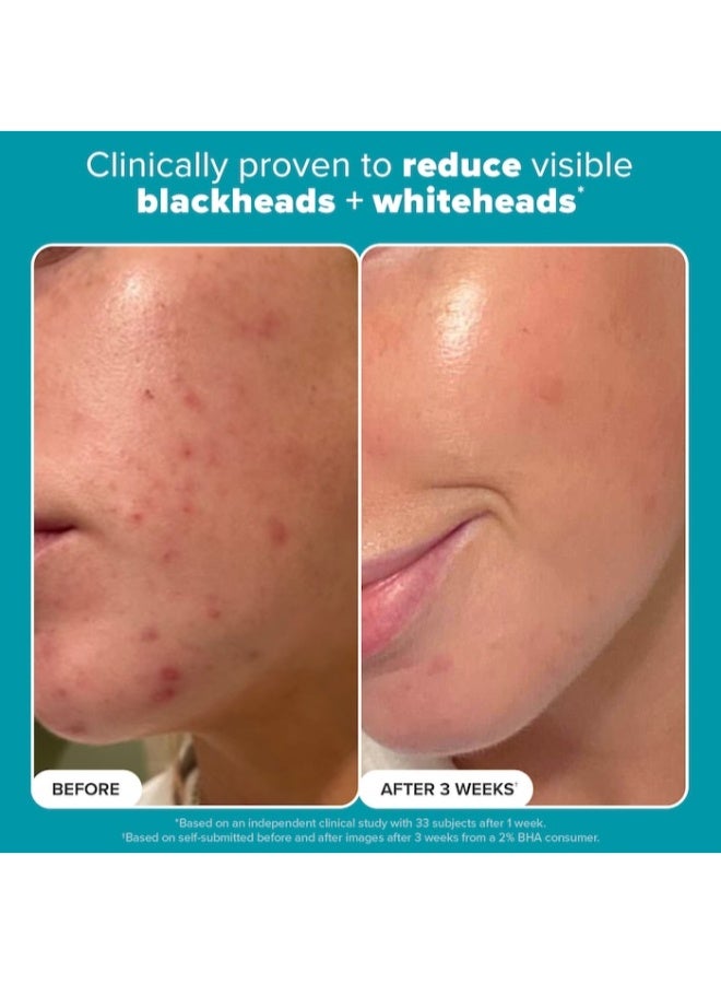 PAULA'S CHOICE Skin Perfecting 2% BHA Exfoliating Toner for Clear Skin 236ml - Image 2