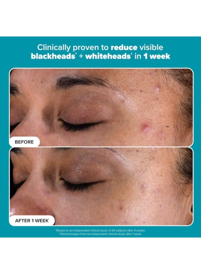 PAULA'S CHOICE Skin Perfecting 2% BHA Exfoliating Toner for Clear Skin 236ml - Image 5