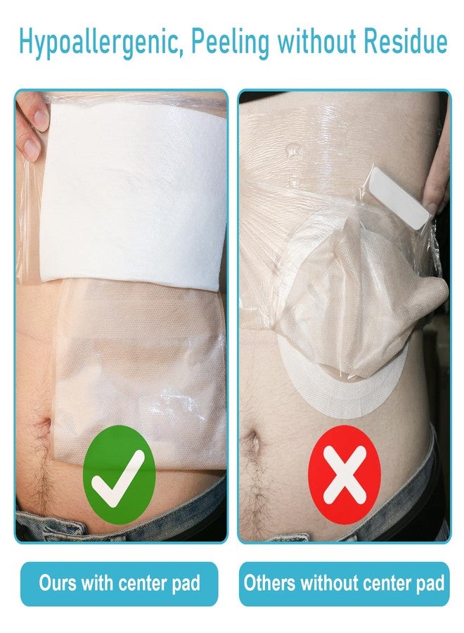 KONWEDA 25 Pcs Waterproof Ostomy Bag Shower Cover 10"x10", Stoma Bath Protector Shield Film Adhesive Dressing Bandage for Ostomy Supply Guard Accessory - Image 4