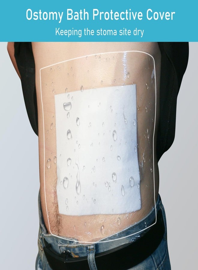 KONWEDA 25 Pcs Waterproof Ostomy Bag Shower Cover 10"x10", Stoma Bath Protector Shield Film Adhesive Dressing Bandage for Ostomy Supply Guard Accessory - Image 2