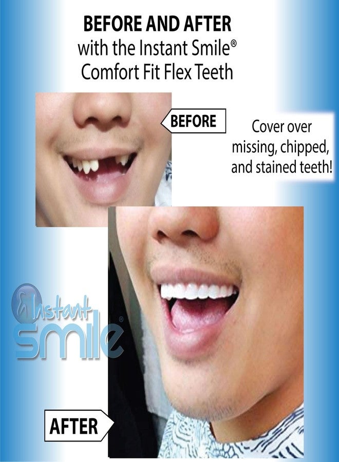 إنستانت سمايل أسنان Instant Smile Flex (لون أبيض ناصع) ومجموعة أسنان Pro Series – منتجان رائعان من Instant Smile - Image 2