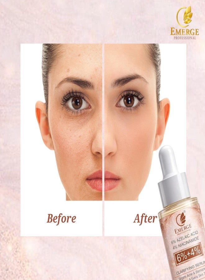 Emerge Professional 6% Azelaic Acid + 4% Niacinamide Clarifying Face Serum for Acne & Blemish Control, Brightening & Even Skin Tone - 30 ml - Image 5