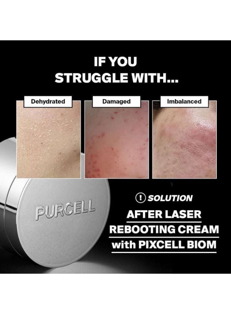 PURCELL PIXCELL BIOM™ After Laser Rebooting Cream – Korean Barrier Recovery Cream with Niacinamide & Panthenol for Sensitive Skin Hydration - Image 2