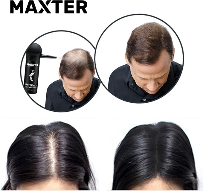 ألياف الشعر بوني - مكثف الشعر لتغطية تساقط الشعر في 30 ثانية - 100% مسحوق قطن طبيعي للنساء والرجال - بني داكن 275 جرام