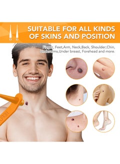 Sefudun 2 In 1 Skin Tag Removal Tool Kit Painless Easy-Using Device For Small To Large Sized Skin Tag On Face Neck And Body， Double Head Wart Removal Tool Skin Tag Removal Orange  - Image 5