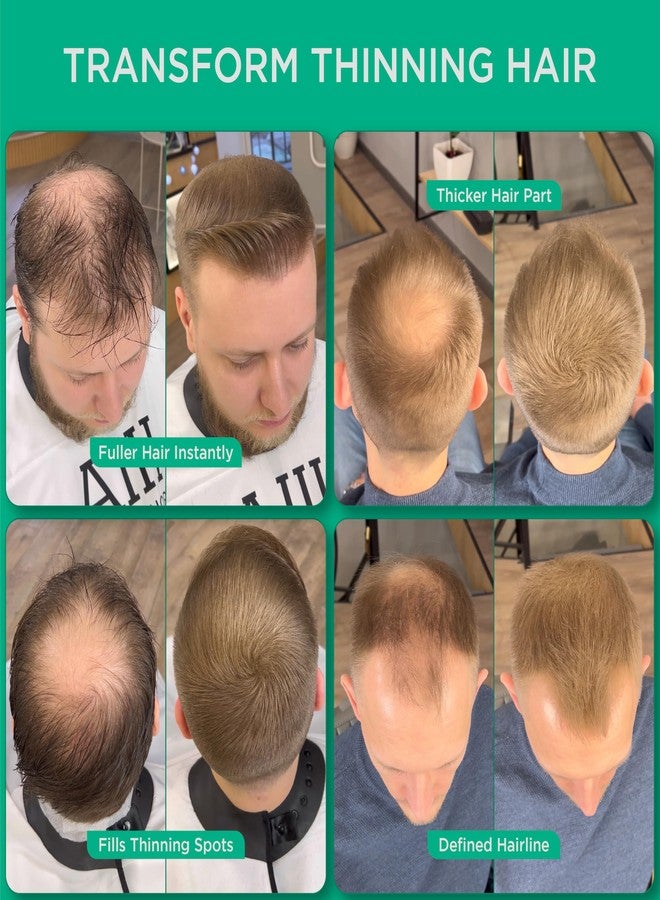 THICK FIBER Hair Building Fibers for Bald Spots & Thinning Hair (LIGHT BROWN, Pack of 3) - 25g Bottle - Conceals Hair Loss in Seconds - Hair Fibers for Men & Women - Image 2