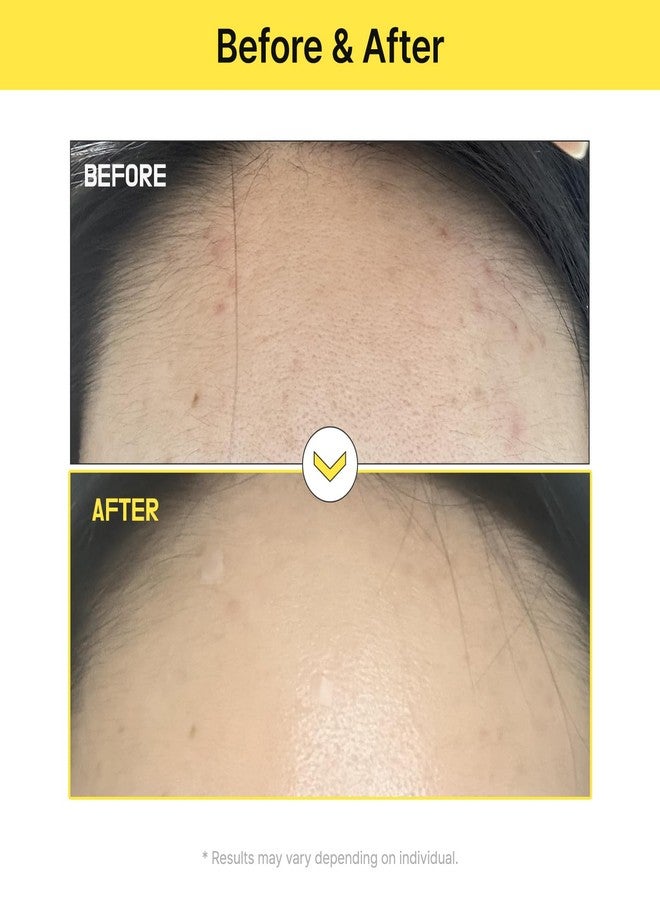 TIA'M كريم تيا م ألفا-5 ميلة للعناية، 1.69 أونصة سائلة، كريم تعزيز الإشراق 5% ألفا أربوتين مع الجلوتاثيون ونياسيناميد، العناية بالبشرة الكورية - Image 2