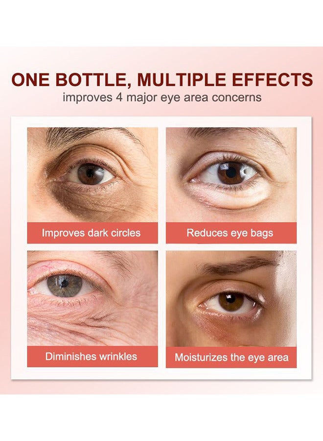 Anti Dark Circles And Eye Bags Cream 20G, Fade Dark Circles, Remove Fine Lines And Eye Bags, Anti-Wrinkle Anti-Aging Firming Brighten Skin Cream, Eye Care Cream