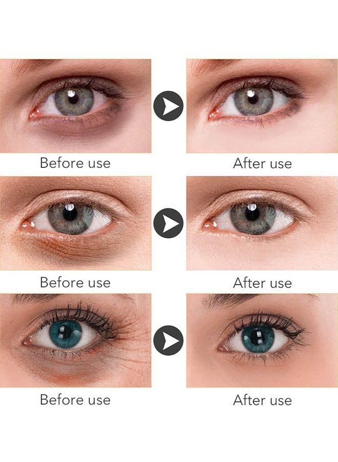 Anti Dark Circles And Eye Bags Cream 20G, Fade Dark Circles, Remove Fine Lines And Eye Bags, Anti-Wrinkle Anti-Aging Firming Brighten Skin Cream, Eye Care Cream