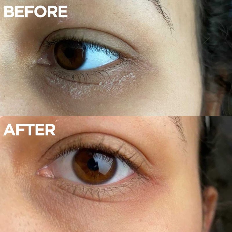 Lanolips كريم لانو ليبس لجميع الاستخدامات مرطب فائق بفيتامين E وكريم لانوين للجسم ومرطب للوجه للبشرة الجافة والمتشققة آمن للعناية بالبشرة والعناية بالجسم للأطفال والرضع 85 مل 29 أونصة - Image 4