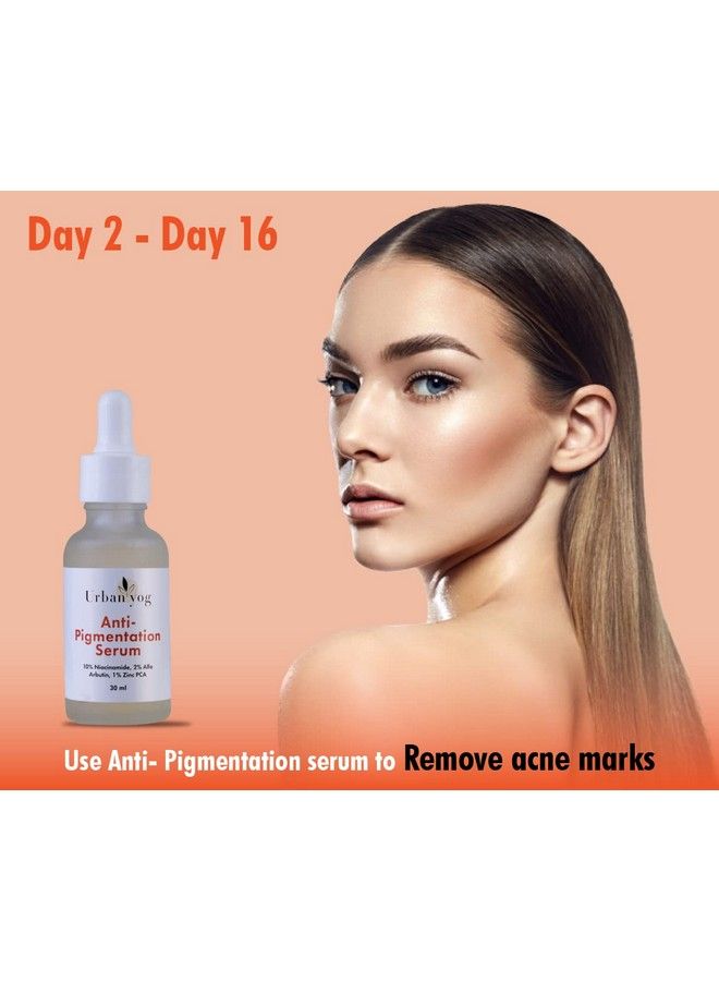 Urban yog Face Care Combo Kit Antipigmentation Serum (30 Ml) And Acne Pimple Patch (72 Dots) For And Clear Skin With 100% Hydrocolloid 10% Niacinamide; For Acne And Dark Spots; For All Skin Types - Image 4