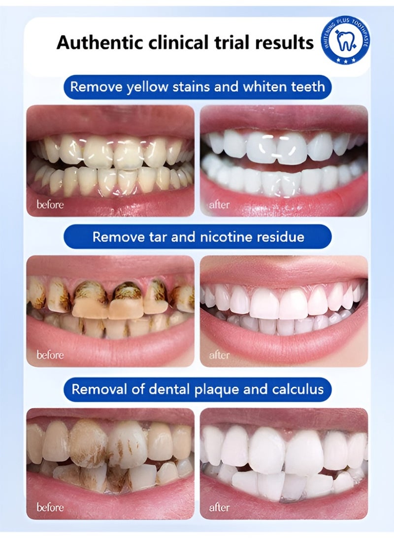 LYDIMOON Smoke Stain Removal Teeth Whitening Toothpaste 100g - Image 4