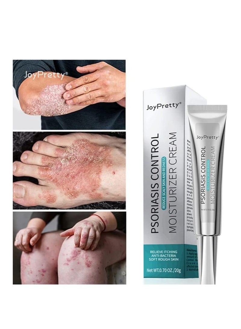 جوي برتي Psoriasis Relief Cream (20g), Anti-Bacterial Moisturizer for Scaly Skin u0026 Redness – Natural Herbal Cream for Eczema, Dermatitis, Psoriasis, and Vitiligo – Unisex Skincare Solution - Image 2
