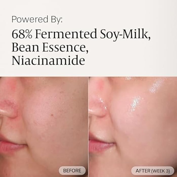 aruen Fermented Tofu Collagen Serum – 68% Fermented Soy Milk with Niacinamide & Hyaluronic Acid – Korean Hydrating Face Serum for Firming, Radiance & Skin Barrier Care (1.01 fl oz / 30ml) - Image 3