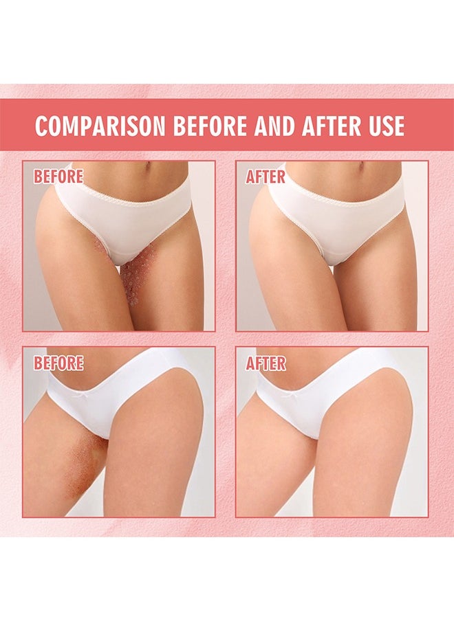 SOUTH MOON Female Private Parts Antipruritic Cream 20g Ointment to Remove Itching Peculiar Smell Dermatitis  - Image 4