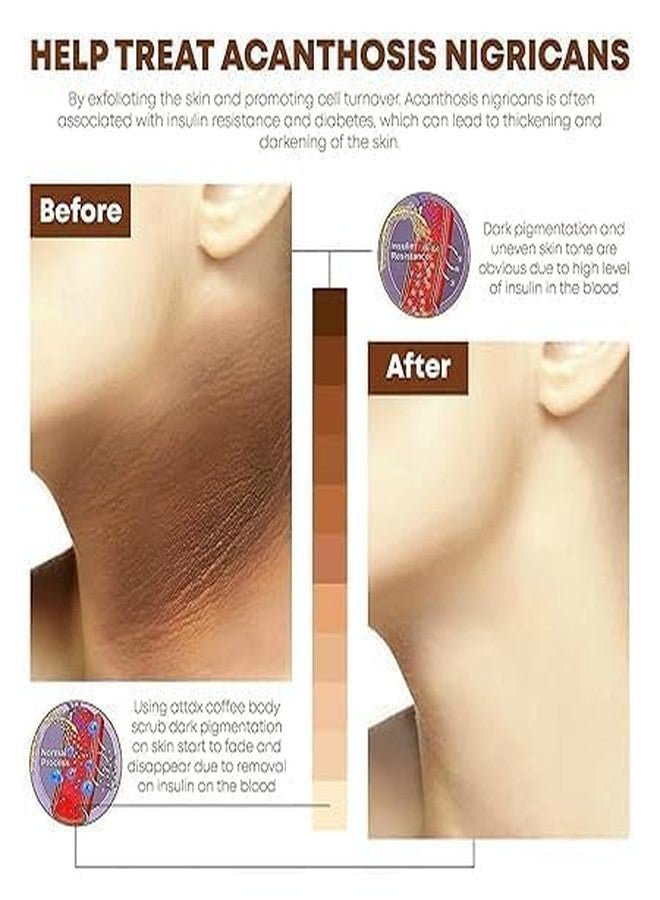 PEACORA Face & Body Scrub | Natural Exfoliating Scrub for Glowing Skin | Deep Cleansing & Exfoliating | Gentle Facial Scrub for All Skin Types (360ml, Vitamin C) - Image 4