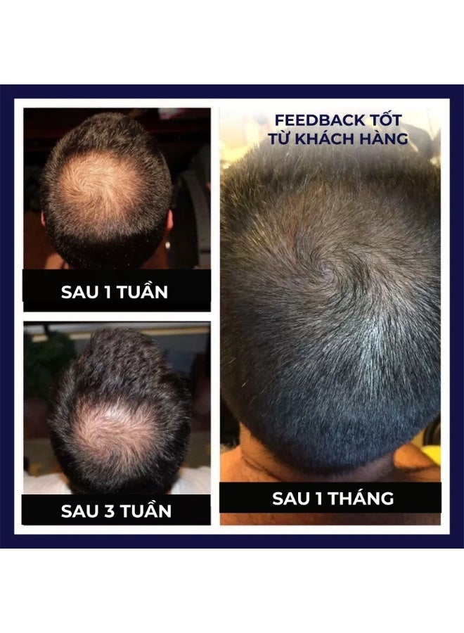 FEG Hair Growth Spray Regrowth Hair Growth Treatment Liquid for Thicker Hair Growth - Image 2