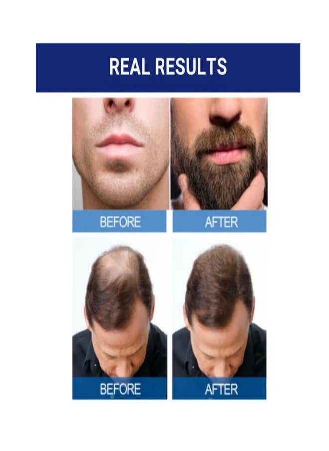 Minoxidil Hair Regrowth Treatment