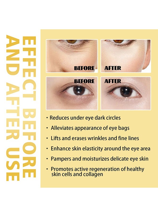 Hoygi - Under Eye Rollerball ，Eye Serum, Frankincense Eye Roller with Castor Oil for Dark Circles, Puffy Eyes, and Wrinkles, Anti Aging Eye Serum Cream, 10ml - Image 1