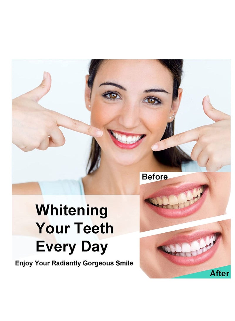 SYOSI ضوء تبييض الأسنان، ترقية جديدة، 16 ضوء LED لتسريع تبييض الأسنان، صينية فم، صواني ضوء معززة لتبييض الأسنان، متصلة بجهاز iPhone/Android/Type-C للاستخدام المنزلي - Image 2