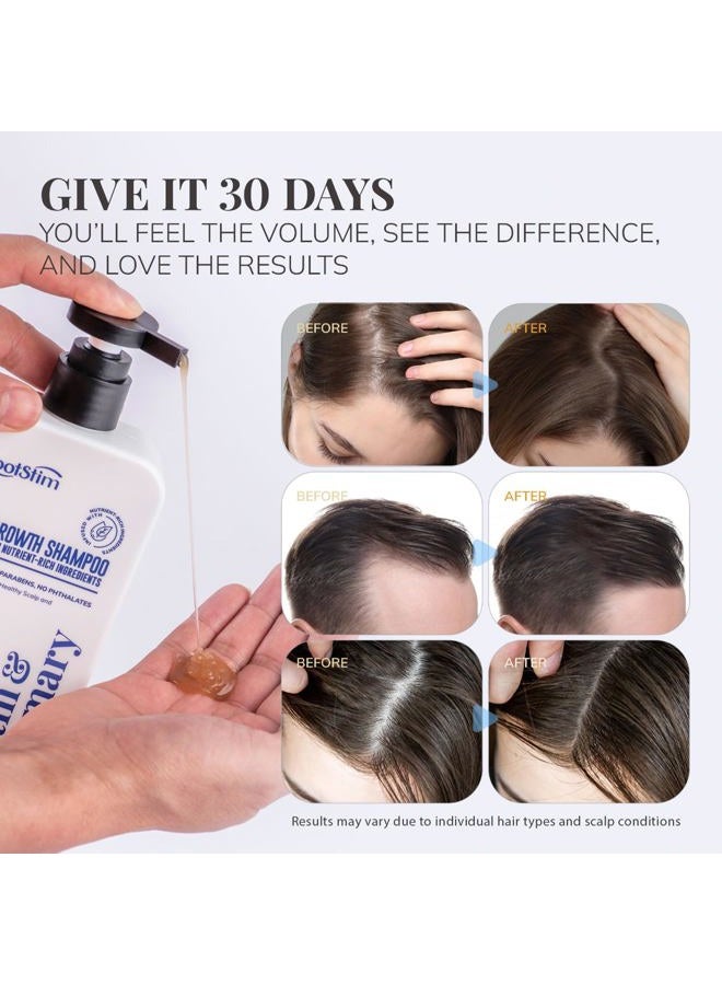 RootStim Biotin Rosemary Hair Growth Shampoo: Shedding Thinning, Enriched With Nutrient Rich Natural Ingredients, Sulfate Free Thickening, 10 Fl Oz - Image 5