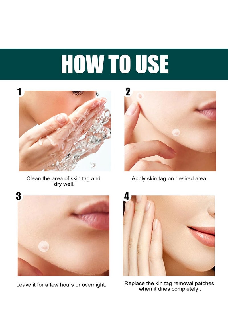 General - Patches Acne Patch,122 Face Patch for Pimple Zit, Hydrocolloid Pimple Repair Patch for Face Zits, Waterproof, Reduces Pain & Redness of Acne - Image 1