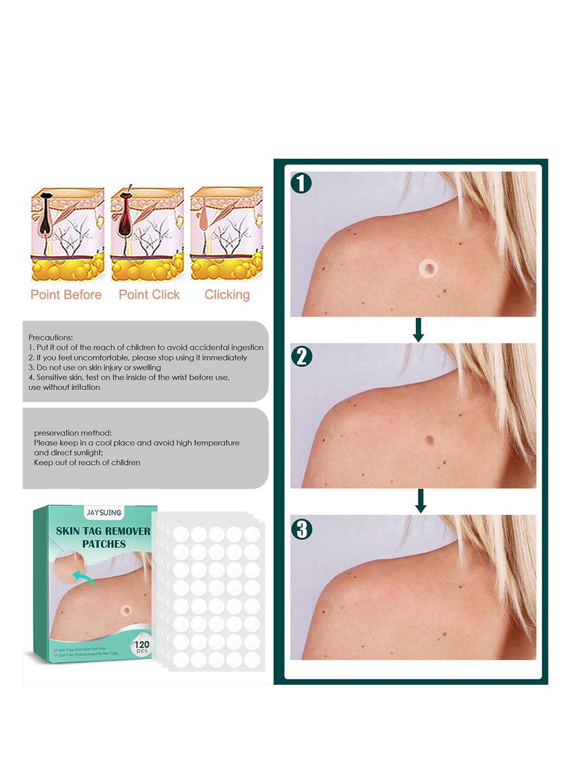 General - Patches Acne Patch,122 Face Patch for Pimple Zit, Hydrocolloid Pimple Repair Patch for Face Zits, Waterproof, Reduces Pain & Redness of Acne - Image 1