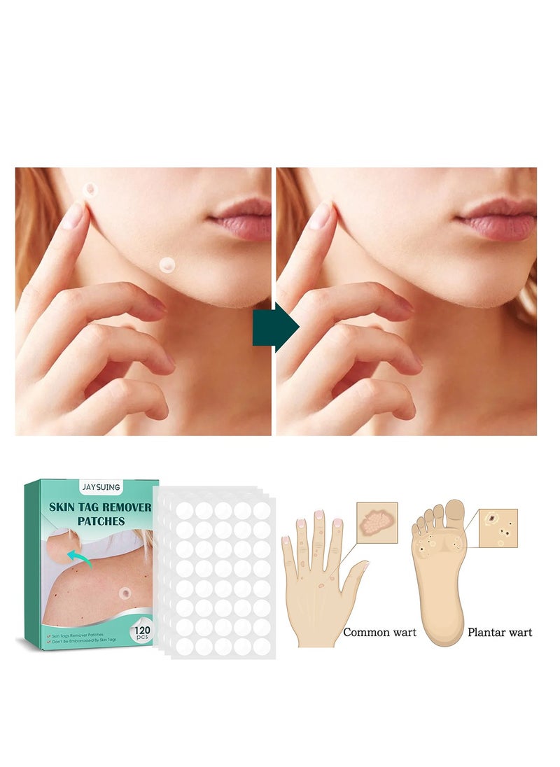 General - Patches Acne Patch,122 Face Patch for Pimple Zit, Hydrocolloid Pimple Repair Patch for Face Zits, Waterproof, Reduces Pain & Redness of Acne - Image 1