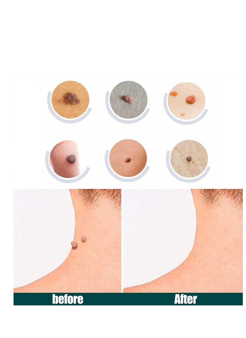 General - Patches Acne Patch,122 Face Patch for Pimple Zit, Hydrocolloid Pimple Repair Patch for Face Zits, Waterproof, Reduces Pain & Redness of Acne - Image 1