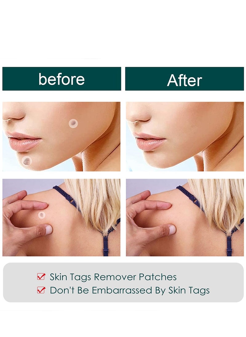 General - Patches Acne Patch,122 Face Patch for Pimple Zit, Hydrocolloid Pimple Repair Patch for Face Zits, Waterproof, Reduces Pain & Redness of Acne - Image 1
