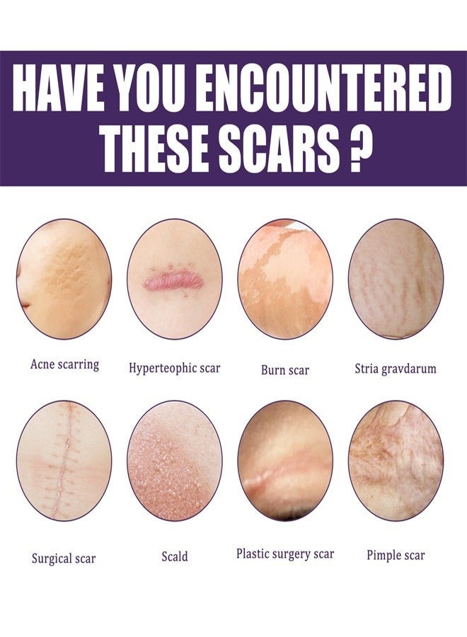 EELHOE 1 Pack/8 Pcs Silicone Scar Sheet, Made With Ultra-Thin Flexible Fabric Instead of Rubber, For Scars Offer Comfort Protection, Effectively Soften, Flatten and Diminish New And Old Scars - Image 3