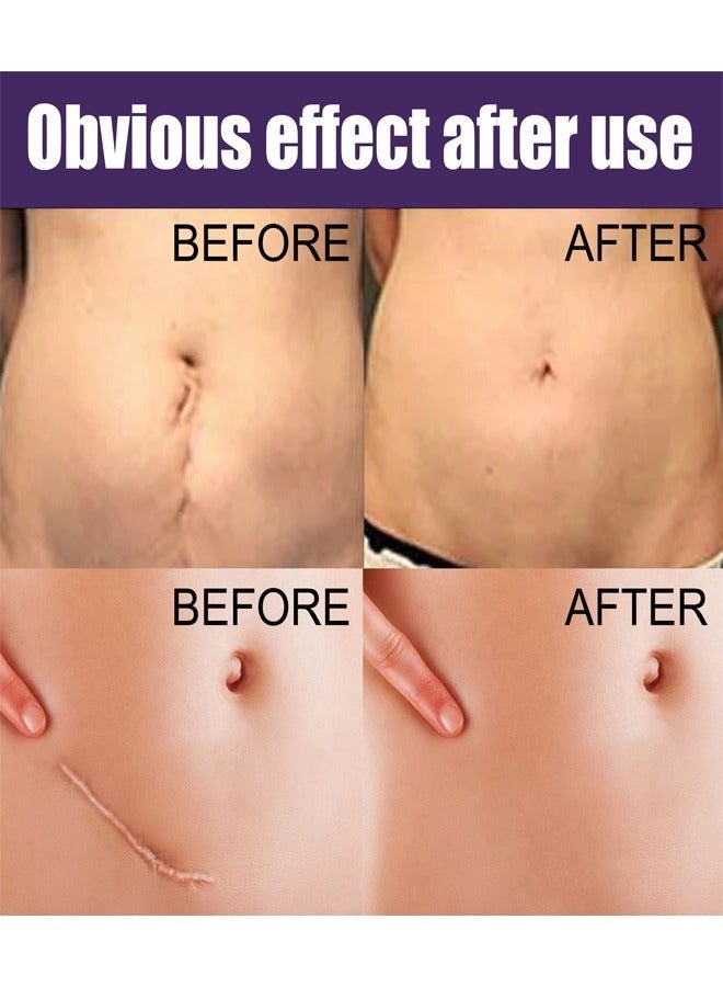 EELHOE 1 Pack/8 Pcs Silicone Scar Sheet, Made With Ultra-Thin Flexible Fabric Instead of Rubber, For Scars Offer Comfort Protection, Effectively Soften, Flatten and Diminish New And Old Scars - Image 5