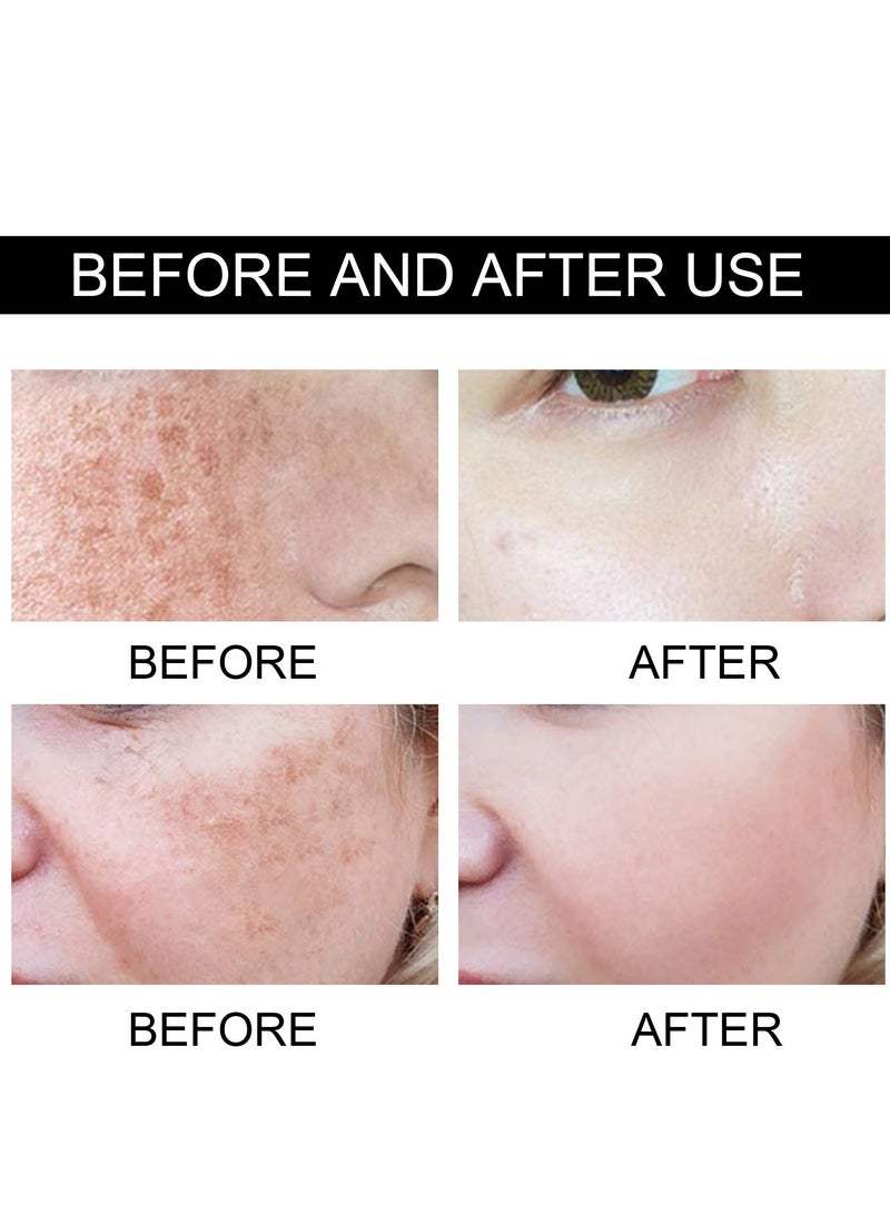 إيلهو معالج البقع الداكنة للوجه، يحتوي على الريتينول وفيتامين C، كريم لتصحيح وإزالة البقع الداكنة والتصبغات، تبييض وترطيب البشرة. - Image 3