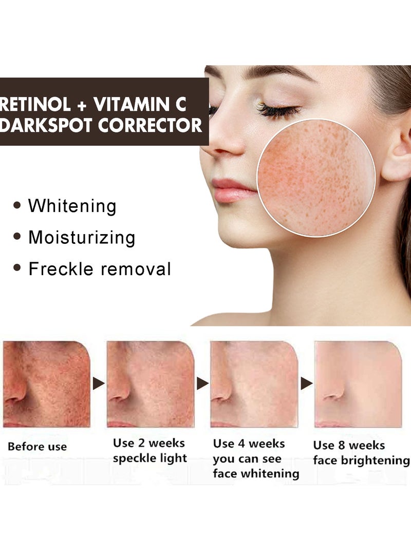 إيلهو معالج البقع الداكنة للوجه، يحتوي على الريتينول وفيتامين C، كريم لتصحيح وإزالة البقع الداكنة والتصبغات، تبييض وترطيب البشرة. - Image 2