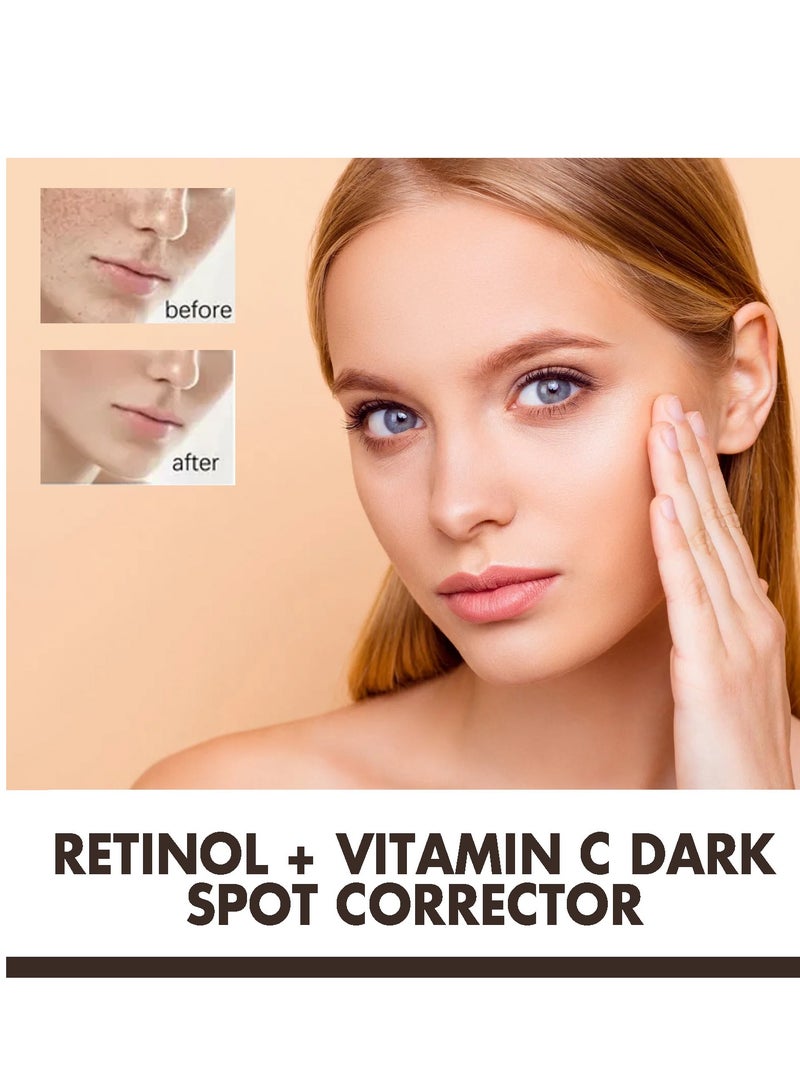إيلهو معالج البقع الداكنة للوجه، يحتوي على الريتينول وفيتامين C، كريم لتصحيح وإزالة البقع الداكنة والتصبغات، تبييض وترطيب البشرة. - Image 4