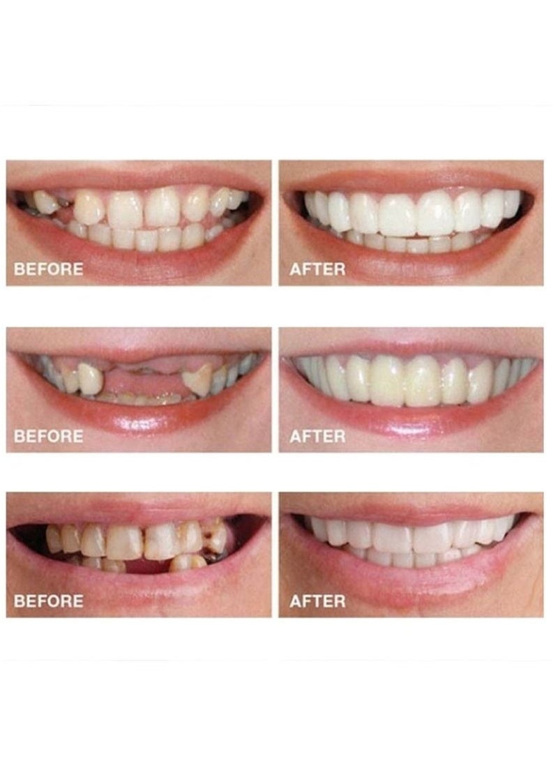 Generic Snap-On Smile Veneers: Removable Comfortable Veneer Covers for Teeth Whitening & Dental Alignment，Alternative to Traditional Braces  - Image 5