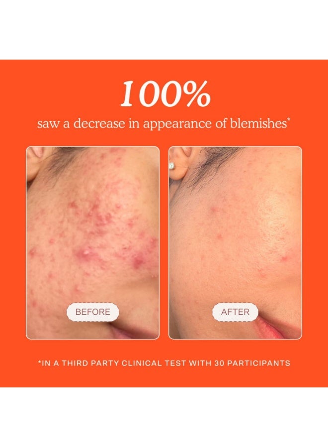 TOWER 28 برج 28 بيوتي رذاذ الوجه اليومي المنقذ المصغر SOS - Image 4