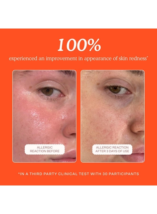 TOWER 28 برج 28 بيوتي رذاذ الوجه اليومي المنقذ المصغر SOS - Image 3