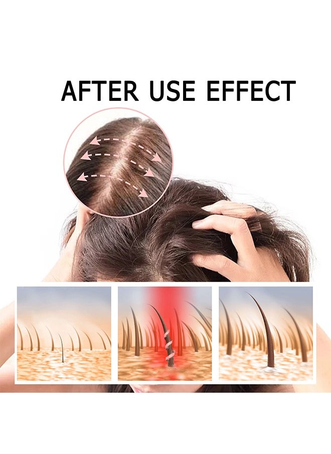 West&Month Batana Oil KIT-  100% Natural Batana Oil Organic With Micro-Needle Roller ,Hair Growth For Men & Women, Enhances Hair & Skin Radiance  - Image 3