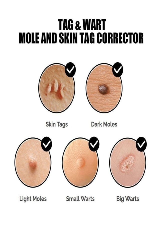 EELHOE - Organic Tags Solutions Serum, Mole Corrector Skin Tag Remover, Organic Skin Spot Purifying Serum Tags Free Mole & TAG Removal New-All Natural (1Pcs) - Image 1
