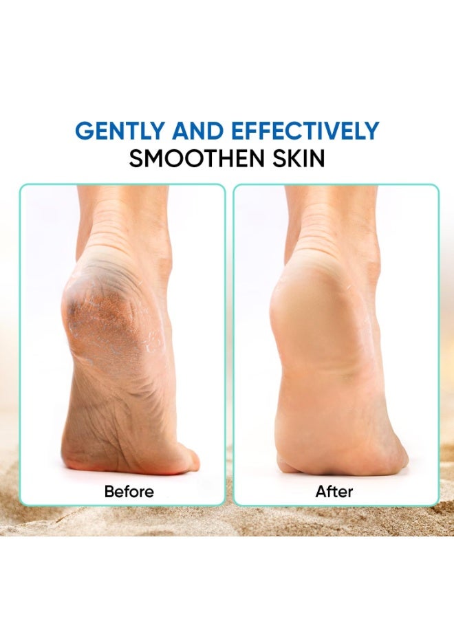 مزيل مسامير القدم الاحترافي 4 في 1 - مبرد قدم مزدوج الجوانب من حجر الطحن الطبيعي مع فرشاة - أداة تقشير القدم لإزالة الجلد الخشن والجلد الميت والكعب الخشن - مقشر قدم سهل الاستخدام (لون عشوائي) - Image 4