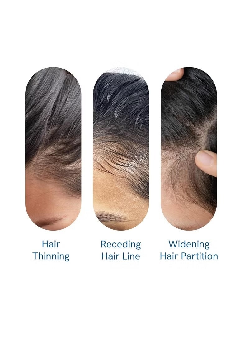 Be Bodywise Hair Growth Serum Roll On – 3% Redensyl & 2% Anagain with Rosemary | Thicker, Stronger Hair – 1 Pack - Image 3