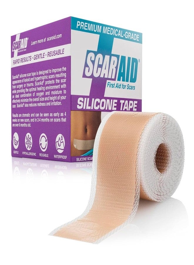 ScarAid شريط سيليكون مخصص للندبات - شريط سيليكون قابل للغسل وإعادة الاستخدام للندبات الناتجة عن الولادة القيصرية، والندبات الجدرية، واستئصال الثدي، وحب الشباب، والندبات الجراحية، وغيرها - مرن، يسمح بمرور الهواء، ولطيف على جميع أنواع البشرة - لفة 1.5 بوصة × 120 بوصة - Image 1