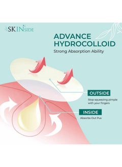Skinside Acne Pimple Patches For Face Pimples (72 Patches) Hydrocolloid Facial Patches With 0.5% Salicylic Acid For Pimple Healing | Invisible Waterproof Absorbs Excess Oil Overnight (72 Patches)  - Image 5
